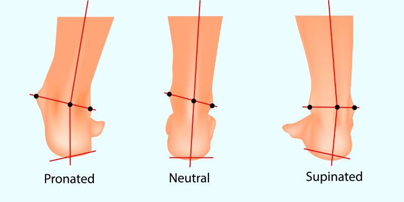 Comprendre foulées