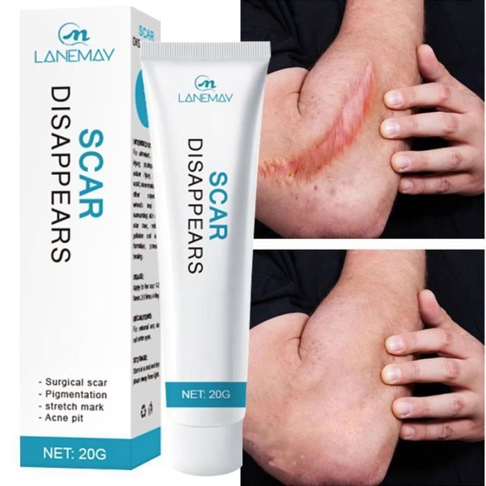 Pommade Wheezal Skookum-Chuck Homéopathique - Pour Psoriasis, Eczéma, Peau Sèche - 25g Neuf