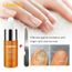 Complement Beaute Des Cheveux Beaute Des Ongles Traitement Ongles Essence Ongles Et Pieds Blanchiment Des Ongles Des Orteils
