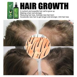 LOTION CAPILLAIRE SURENHAP Spray pour la repousse des cheveux Spray 