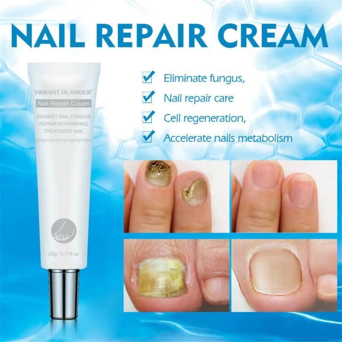 Crème de réparation des ongles Traitement des champignons des ongles Onychomycose Soin des ongles 20ML_I3485