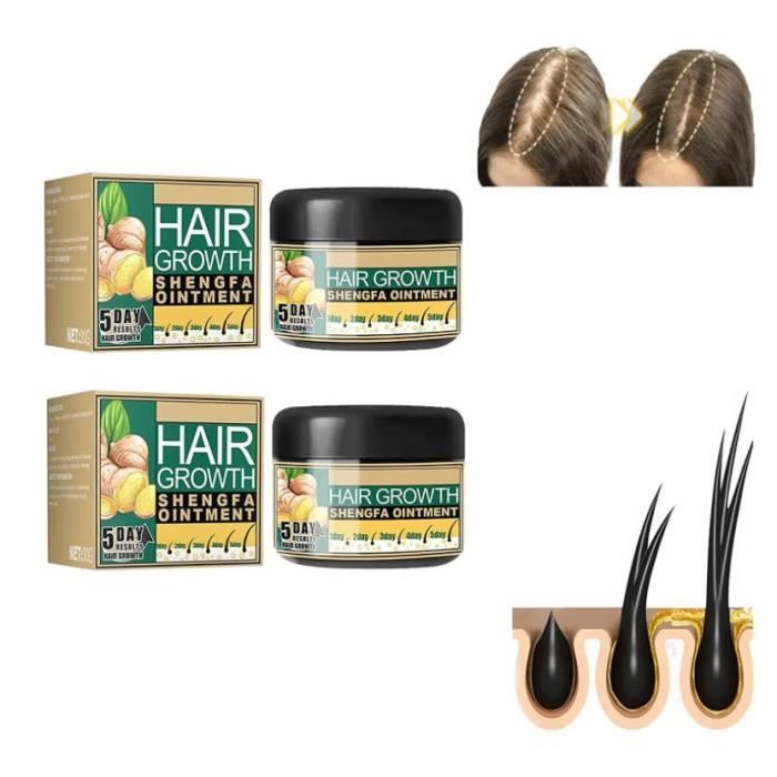 Natural Ginger Hair Growth Cream for Men Women Germinal Hair Thinning Fast Hair Growth