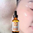 La vitamine C Sérum pour le visage Sérum topique du visage avec la vitamine acide hyaluronique RWwei@5204-3