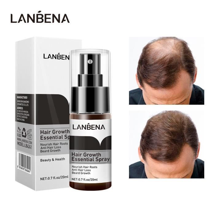 LANBENA Hair Growth Essence Spray Product Preventing Baldness Consolidating  Anti Hair Loss Nourish Roots Easy To Carry Hair Care - Cdiscount Au  quotidien