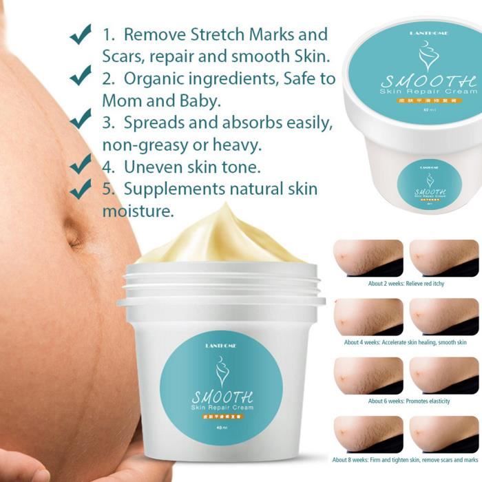 Enlèvement Acné Cicatrice Vergetures Crème Fat Scar Striae Gravidarum Traitement 40g QXH90507082_lucypllo