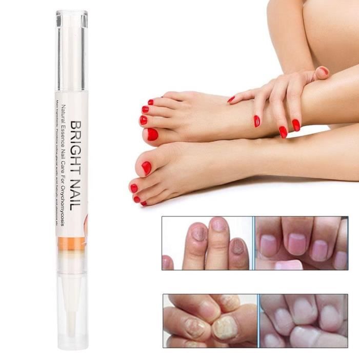 Mycose Ongle Traitement Contre Mycose De Pied Et De Main Solution Antifongique Anti Mycose Soin Reparation Naturel Et Efficace Cdiscount Sante Mieux Vivre
