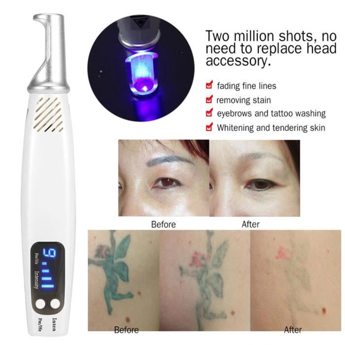 Zerodis Stylo laser pour détatouage Stylo de retrait de tatouage de cicatrice de stylo Laser picoseconde Blu-ray pour la mélanine