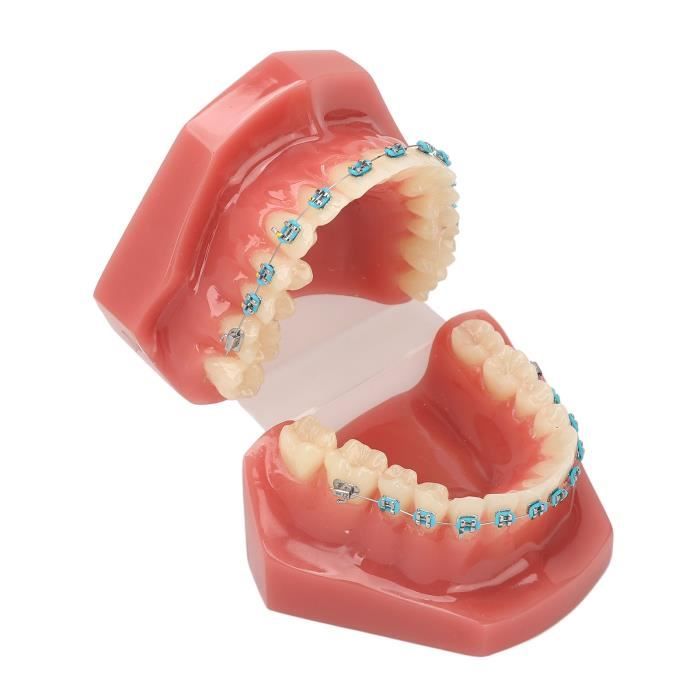 EBTOOLS Modèle de dents d'accolades en métal Modèle orthodontique dentaire  28 pièces modèle de dents d'enseignement dentaire en - Cdiscount Au  quotidien