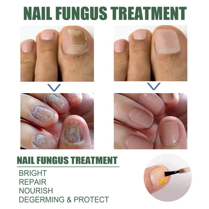 Soin des ongles Nettoie, hydrate et nourrit en douceur les ongles des — free download
