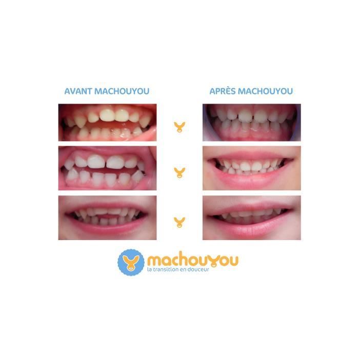Machouyou dispositif de prévention orthodontique 2-6 ans prune