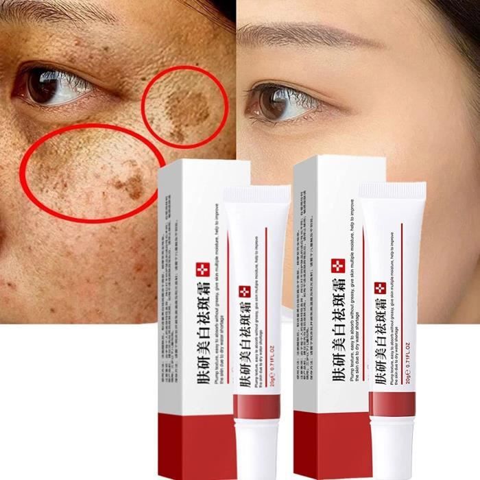 Body Spot Remove Dark Spot Remover for face, Body & Sensitive Areas-Collagen Cream-With ...