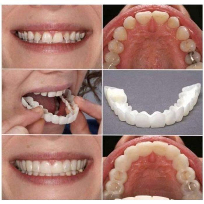 2 Set Silicone Dentier Haut et Bas Sourire Parfait pour Homme et Femme Amovible Naturel Fausse Dents Provisoire Facette Dentaire