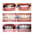2 Set Silicone Dentier Haut et Bas Sourire Parfait pour Homme et Femme Amovible Naturel Fausse Dents Provisoire Facette Dentaire-2