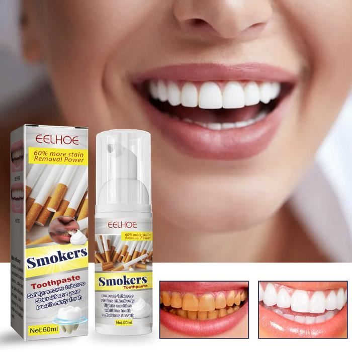 Dentifrice Dentifrice Pour Fumeurs, Gel Blanchissant Détachant Pour Fumeurs, Élimine Les Taches