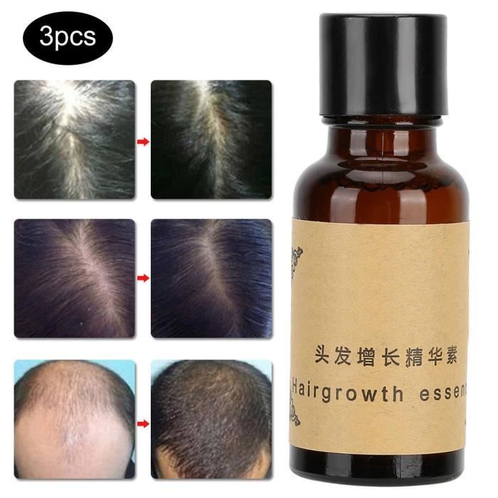 Complément Alimentaire Cheveux & Ongles 30/60/120 Capsules Biotine & Collagène | Balincer DLU 04/2026