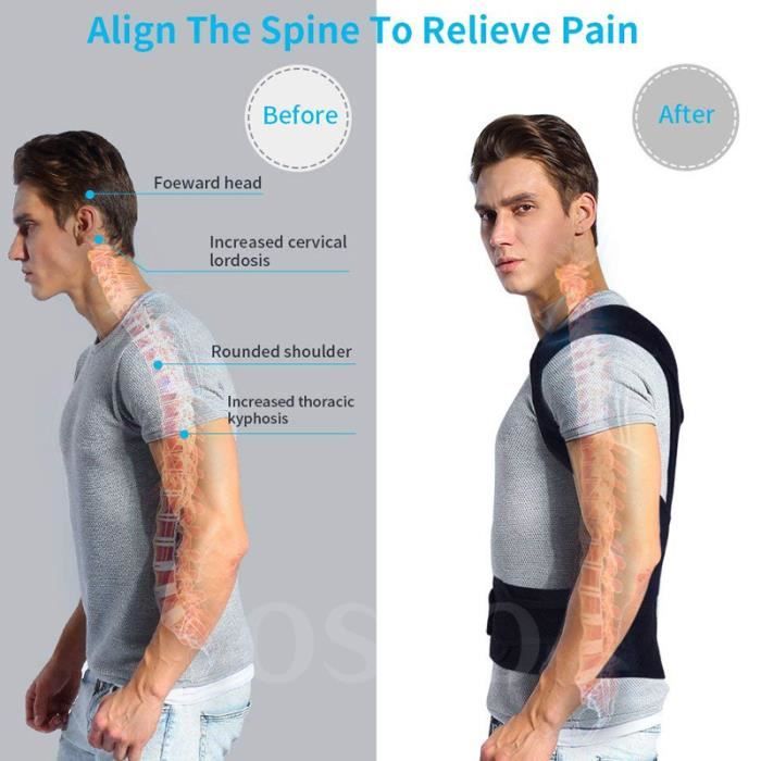 Correcteur de posture du dos masculin et féminin Support de posture Support de la clavicule Flexion et exercice du dos réglable-M