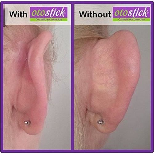 Otostick cosmétiques oreille - Achat / Vente boucle d'oreille Otostick  cosmétiques oreille Homme 