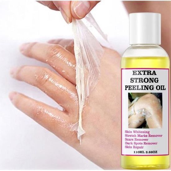 Huile De Peeling Yollow Peeling Extra Fort - 110 Ml - Pour Mains, Pieds, Corps - Contient Vitamines - Fabriqué En Suisse