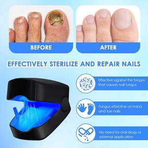 Appareil Contre Les Mycoses Des Ongles Pieds Et Mains - Mycocare, électrique, Silencieux