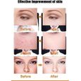 Masque led visage luminotherapie anti acné pour skin care Dispositif de lampe de photothérapie Rajeunissement-2