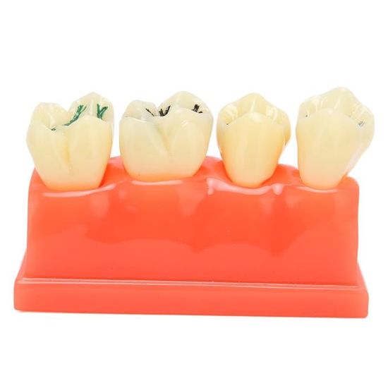 Modèle De Dents Dentaire (Typodont) Kilgore Nissin - Pour Pratique Dentiste - Neuf