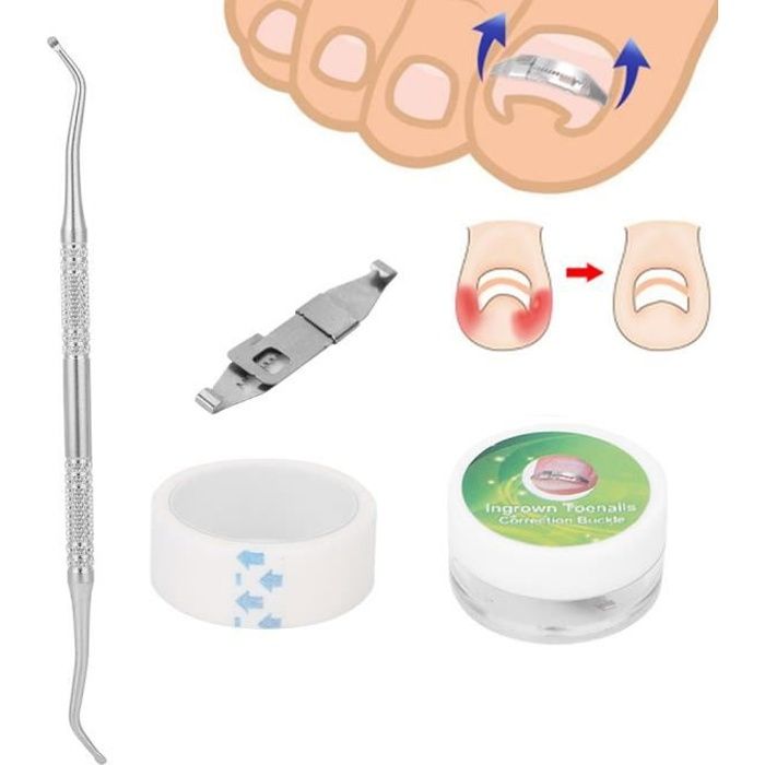 Yosoo Outil De Rabotage D Ongle D Orteil 3 Pieces Correcteur D Ongle Incarne Traitement Paronychie Correction Des Ongles Boucle De Cdiscount Au Quotidien
