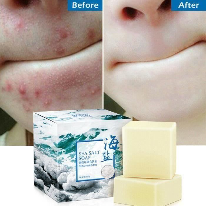 5pcs * 100g Savon au sel de mer naturel au lait de chèvre, éliminer l\'acné, la peau propre, rétrécit les pores, anti points noi