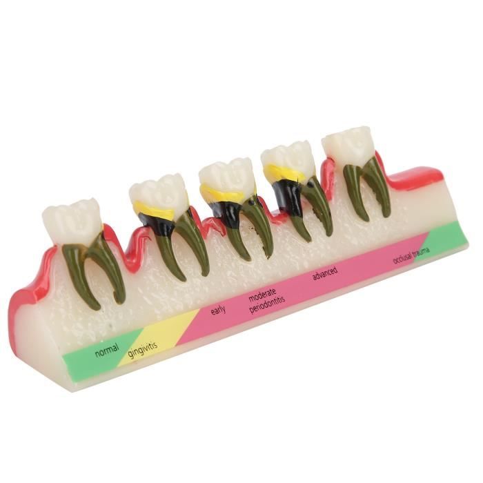 Traitement orthodontique et parodontie - Cabinet Parodontie Paris 11