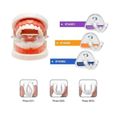 Appareil Dentaire Orthodontique Night Time Correction Physique Invisible Produit De Soins Des Dents - Stade-1