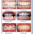 Appareil Dentaire Orthodontique Night Time Correction Physique Invisible Produit De Soins Des Dents - Stade-2