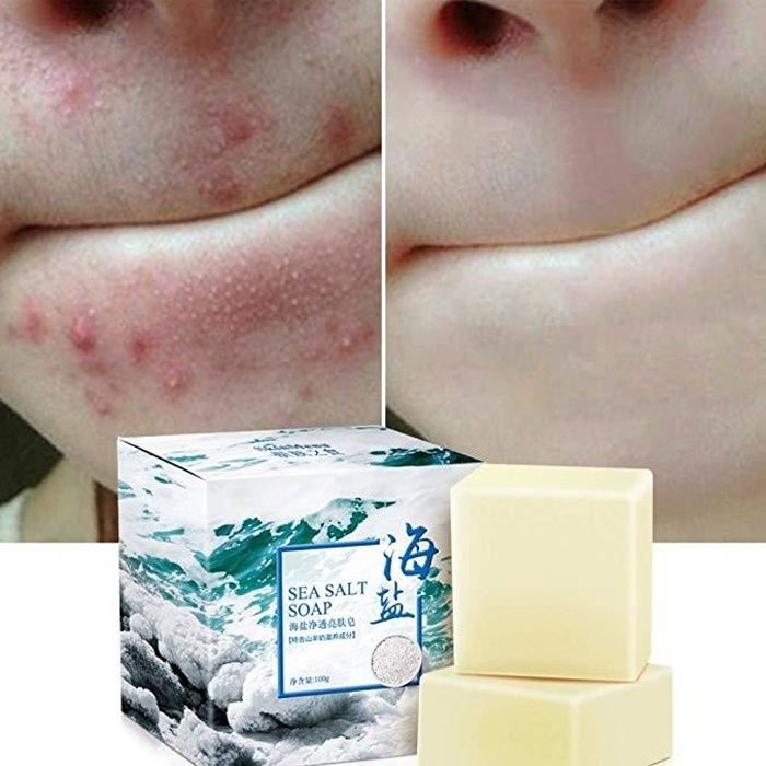 Savon au sel de mer naturel au lait de chèvre, ROMANTIC BEAR cicatrices de points noirs et d’acné savon anti-cellulite, visage pour