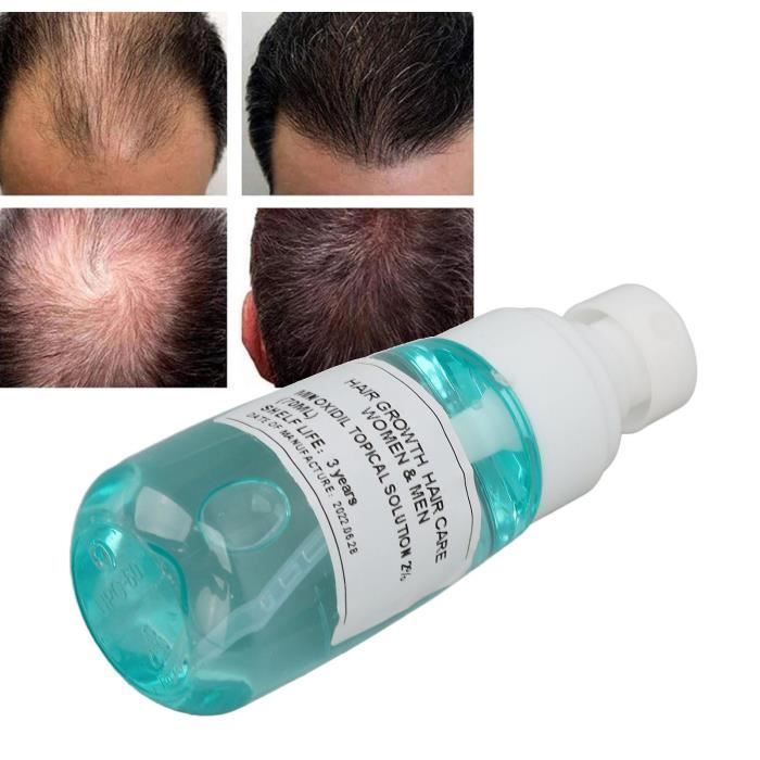Mxzzand Spray pour la croissance des cheveux Minoxidil Minoxidil – Spray  pour la croissance des cheveux, 70ml, parfum traitement