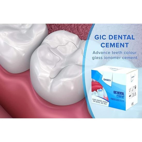 Onirev Ciment Dentaire GIC - Permanent - Rebouchement & Fixation Qu