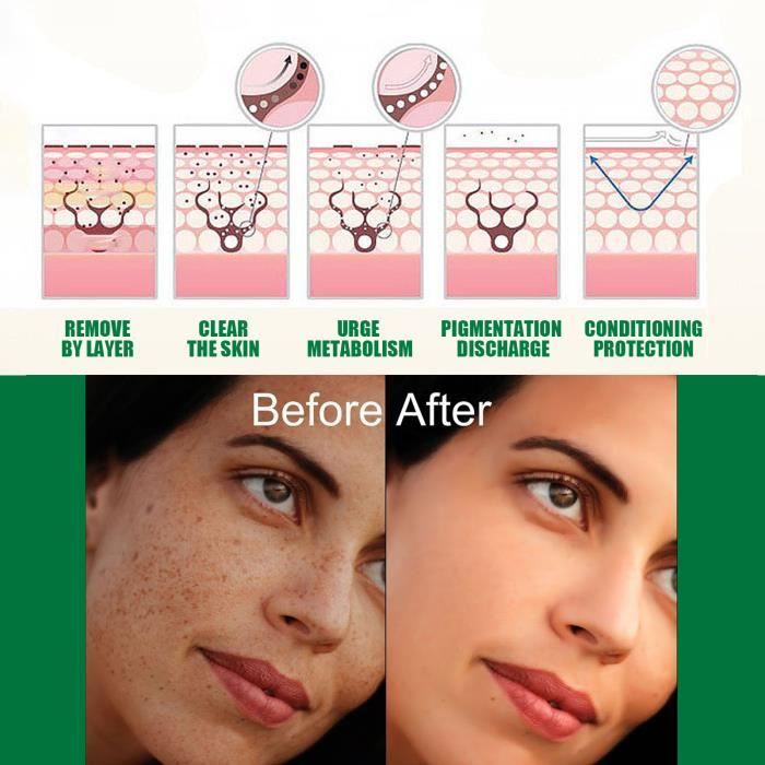 Pack 2 Crèmes Miioto : Anti-Taches Brunes + Anti-Acné - 20g Chacune - Neuf - Pour Peaux Sèches