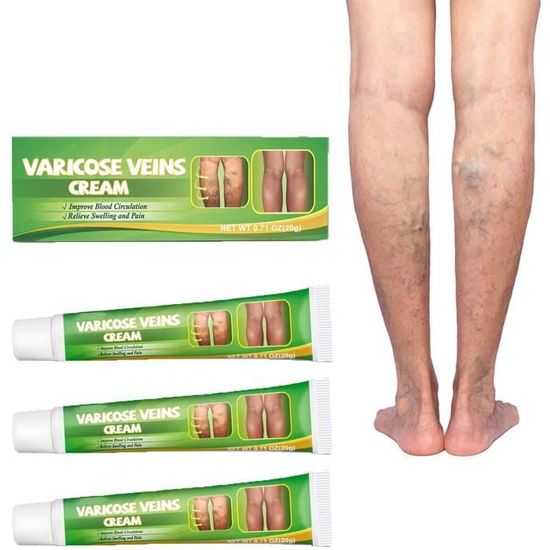 Crème apaisante pour les jambes antivarices, crème de traitement des varices, élimine les