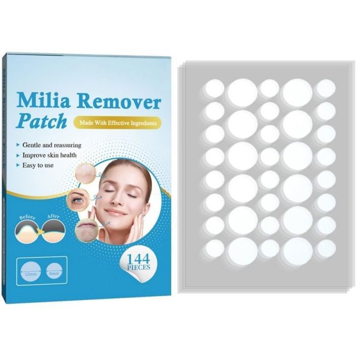 ACCESSOIRES BEAUTE - BIEN-ETRE - PIECES BEAUTE 144 pièces Pour Éliminer les Grains de Milium Soin Doux et Facile ACCESSOIRES BEAUTE