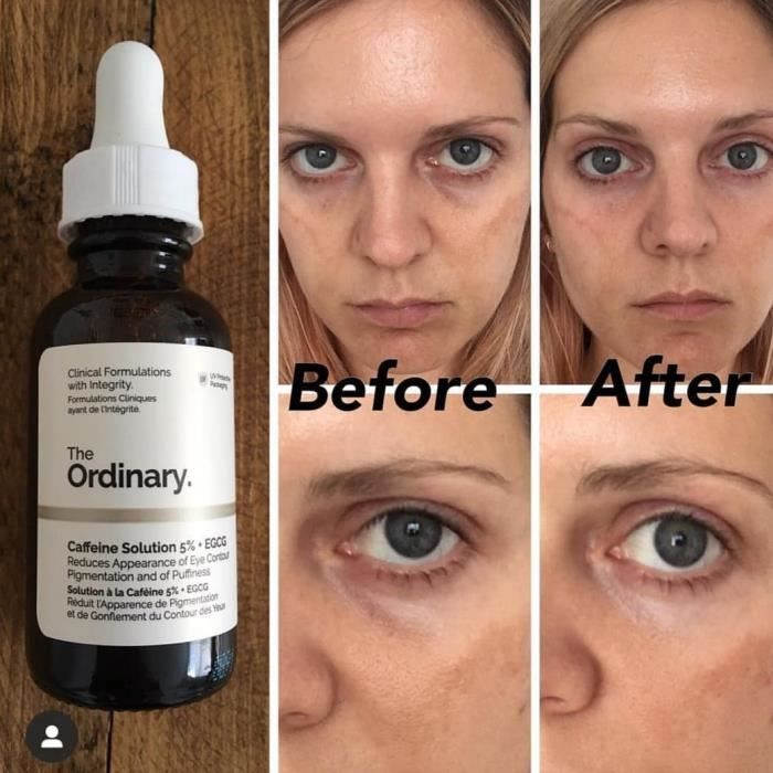The Ordinary solution de caféine Essence anticernes yeux 5 + EGCG 30 ml Cdiscount Au quotidien
