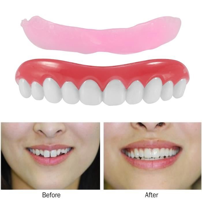 Gouttiere Dentaire Faux Faux Dentiers Cosmetiques Dentaires Placage Superieur Ensemble Outil Dentaire De Remplacement Achat Vente Gouttiere Dentaire Gouttiere Dentaire Faux Fau Cdiscount