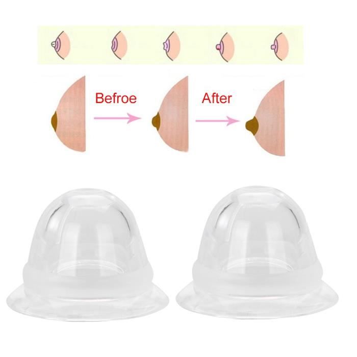 Correcteur De Mamelon En Silicone - Tracteur De Mamelon Inversé Pour Allaitement - Ventouse Rétractable Hohold