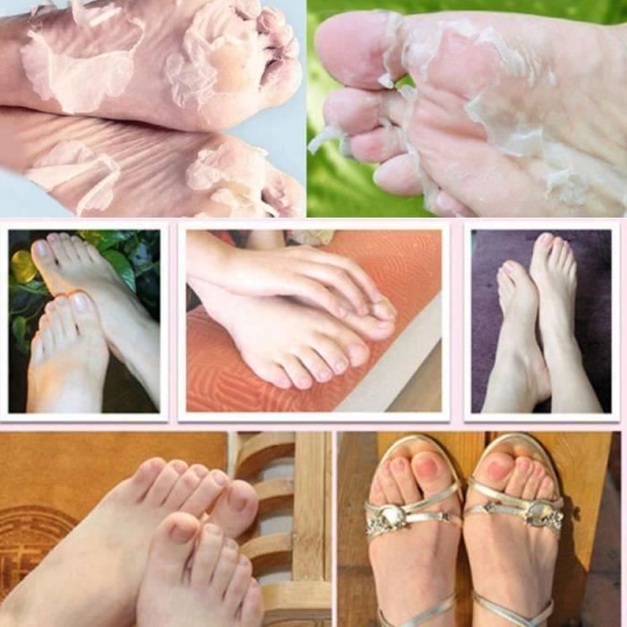 Fragrant Muddy Muscular 1pair Rose Exfoliant Masque Peel Baby Foot Pieds doux Callus dur Retirez mort de ski ZZP80314826 - Cdiscount Au quotidien Fragrant Muddy Muscular 1pair Rose Exfoliant Masque Peel Baby Foot Pieds doux Callus dur Retirez mort de ski ZZP80314826 - Cdiscount Au quotidien