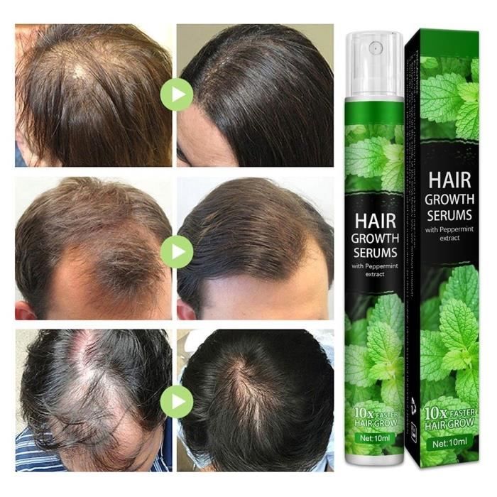 Spray Bionétique Stimulant Croissance Cheveux - 50 Ml, Soin Capillaire Naturel, Neuf