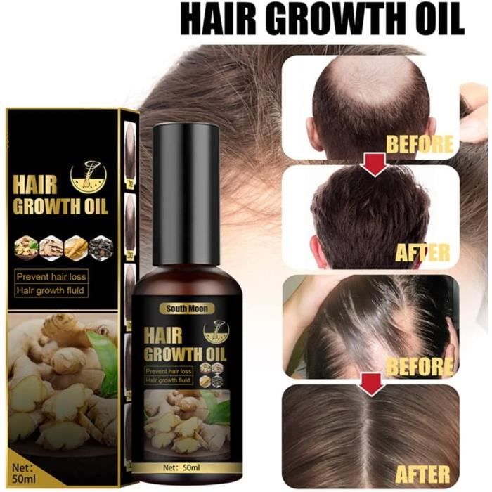 Hair max 2 spray shop