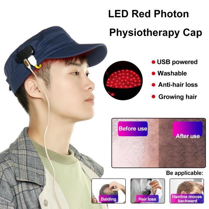 perte de cheveux casquette 51 remise