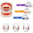 Appareil Dentaire Orthodontique Night Time Correction Physique Invisible Produit De Soins Des Dents - Stade I~III-0