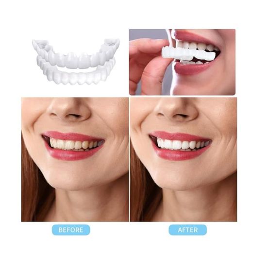 Faux Dentier Sourire Parfait, 2 Paires Dent Provisoire Fausse Dent Dentier  Amovible Haut et Bas, Facette Prothese Dentaire, - Cdiscount Au quotidien