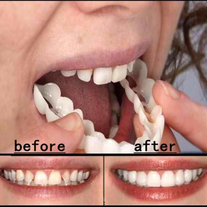 Dentier blanc pour Sourire - Faux Dents Couverture Cosmétique - Cdiscount  Au quotidien