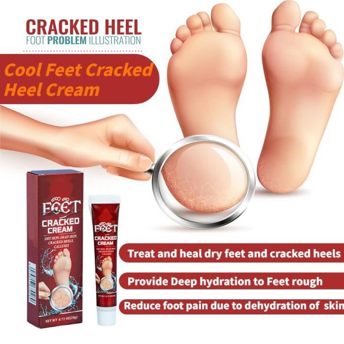 Feet heal top