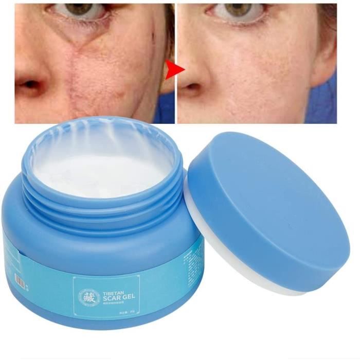 Crèmes pour le corps Crème anticicatrice, cicatrices de réparation de la peau, brûlures