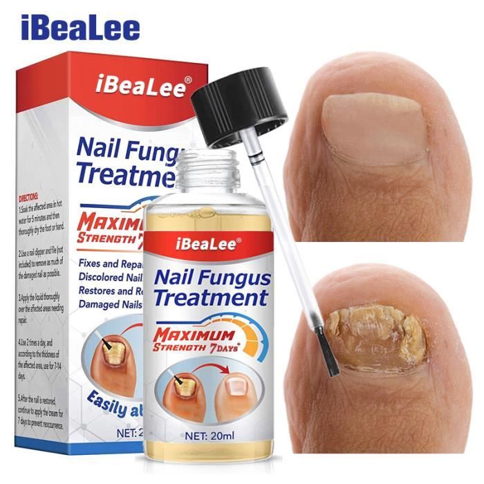 Traitement Anti-champignons Pour Ongles - Stick Réparateur - Neuf - Fabriqué En Chine