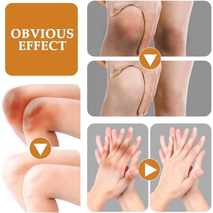 Crème éclaircissante intensive pour les genoux et les coudes foncés